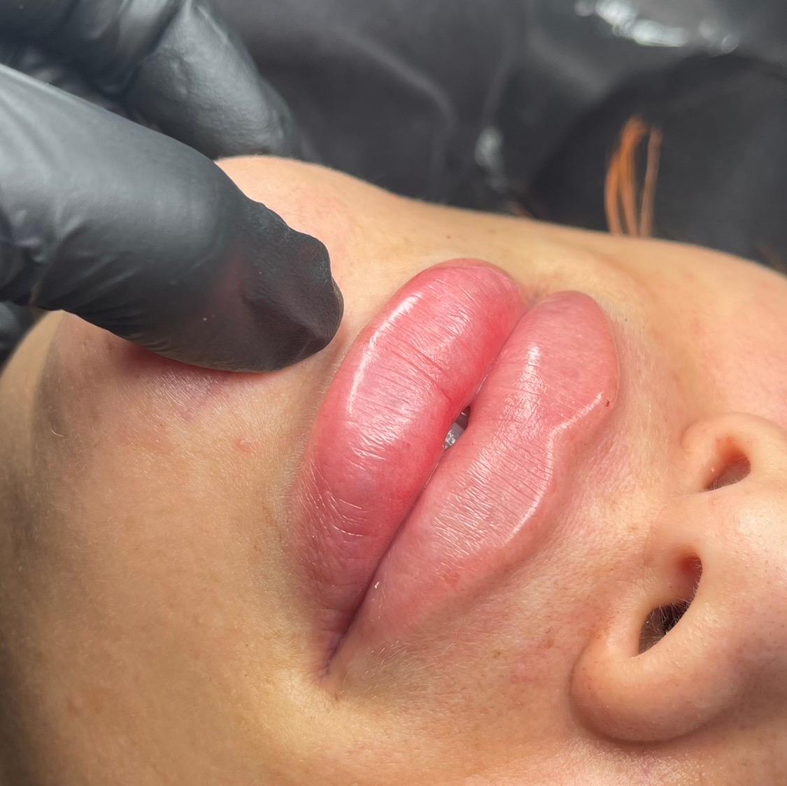 So vain aesthetics - SVA CLINIC LTD image 2