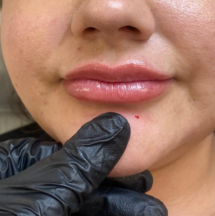 Precision Cosmetics Clinic image 2