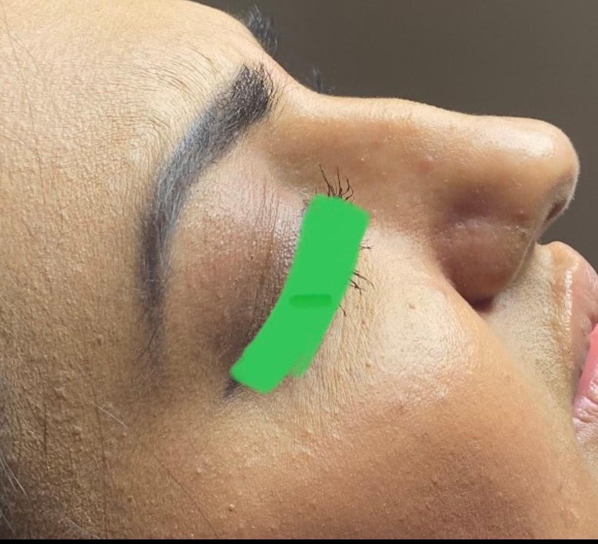 Beverley Jayne Aesthetics image 2