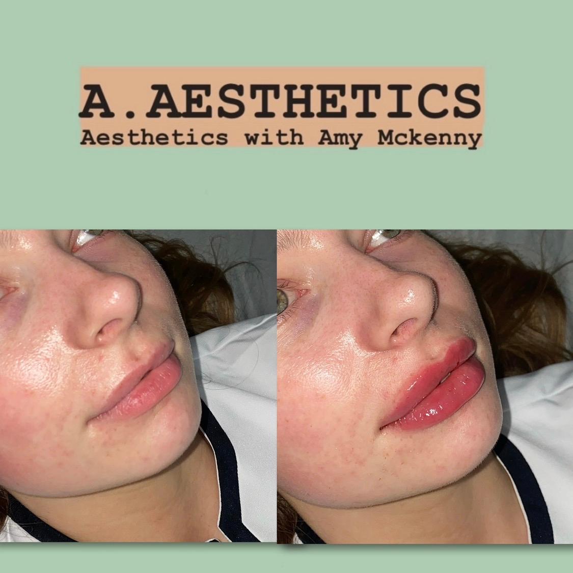 Alm Aesthetics image 3