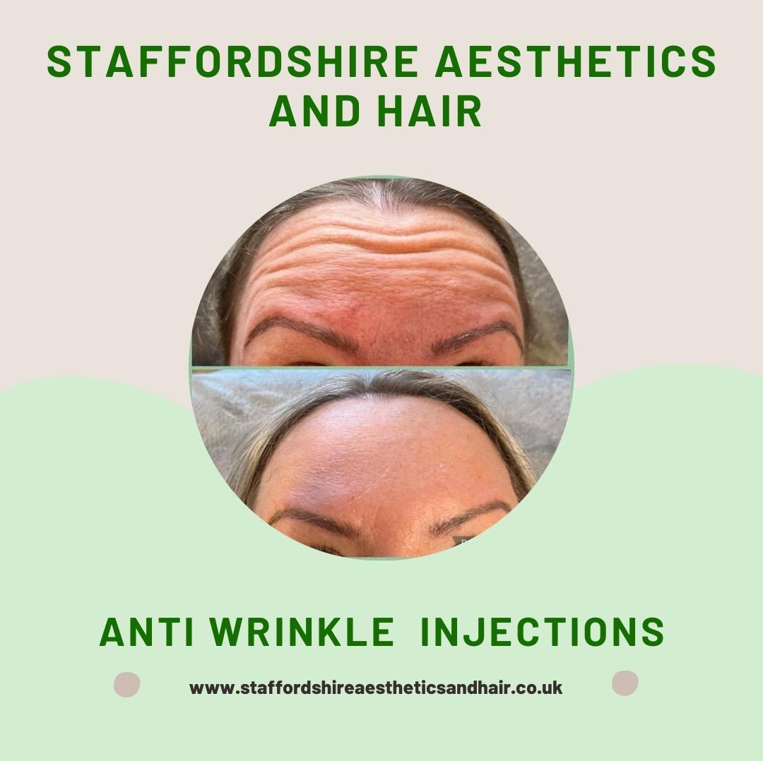 Staffordshire Aesthetics and Hair image 2