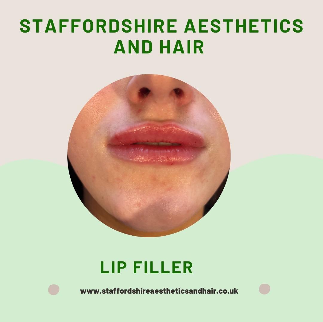 Staffordshire Aesthetics and Hair image 3