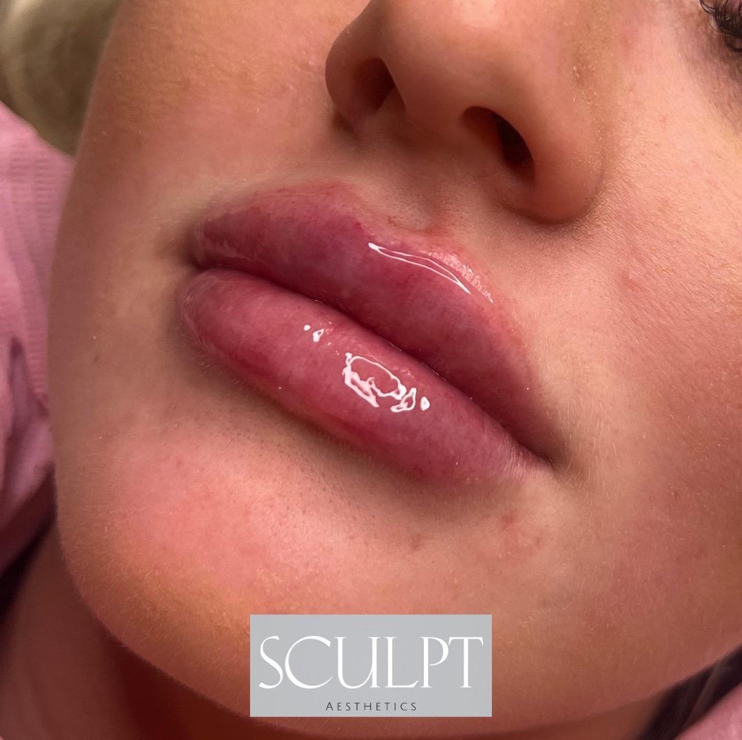 Sculpt Aesthetics image 2