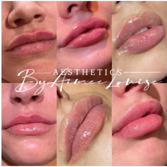 Aestheticsbyaimeelouise BLISS clinic image 2