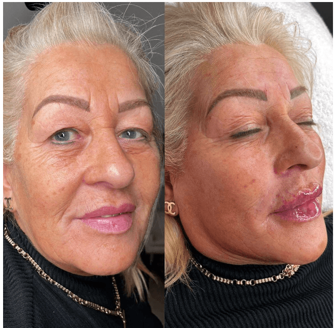 Aestheticsbyaimeelouise BLISS clinic image 3
