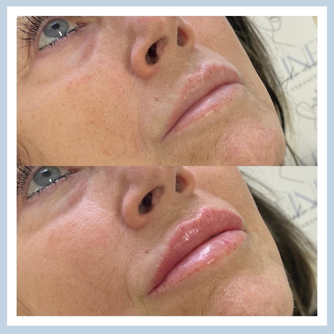 Refined Beauty Enhancements image 2