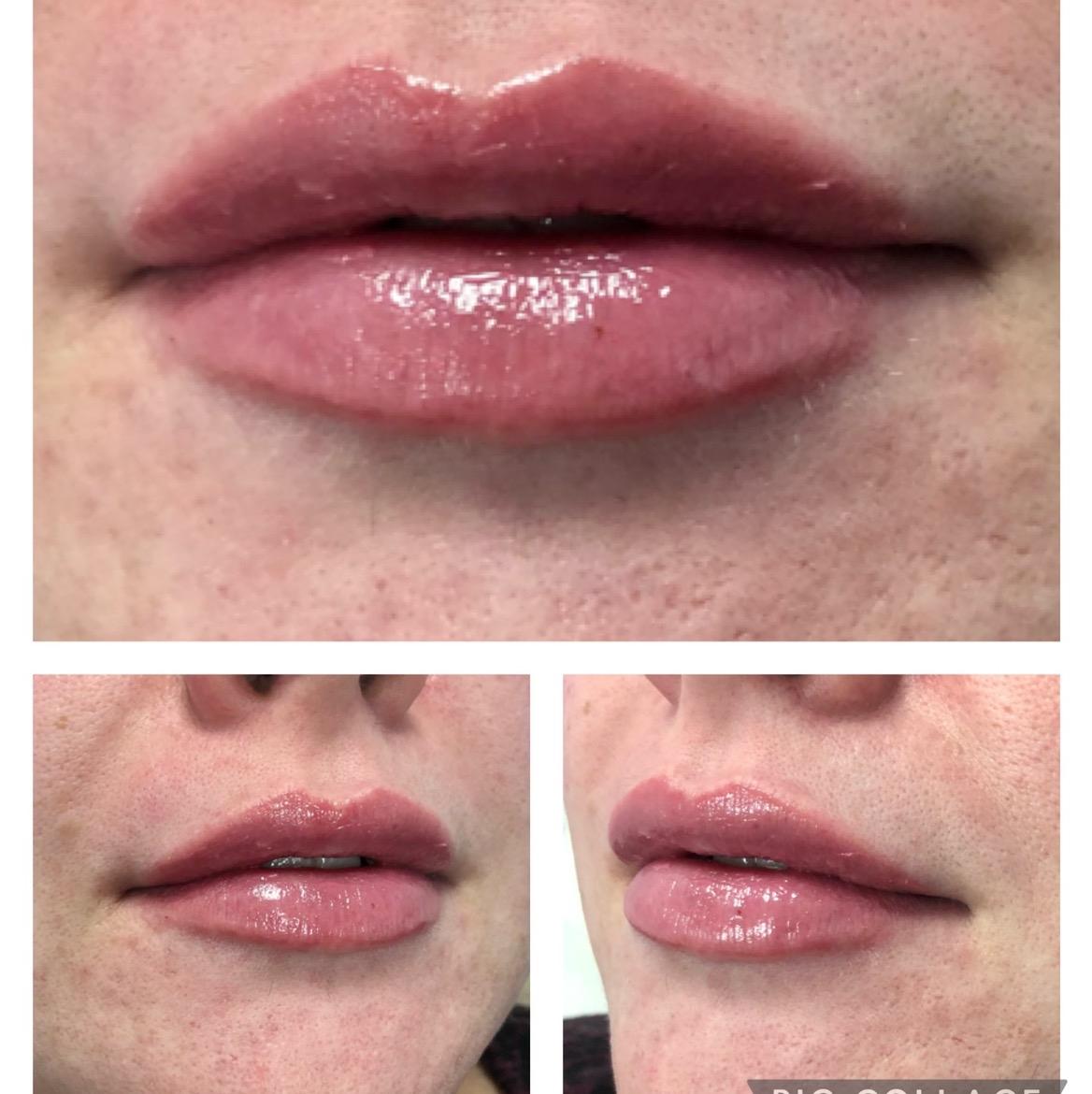 Revive Aesthetics Glasgow image 2