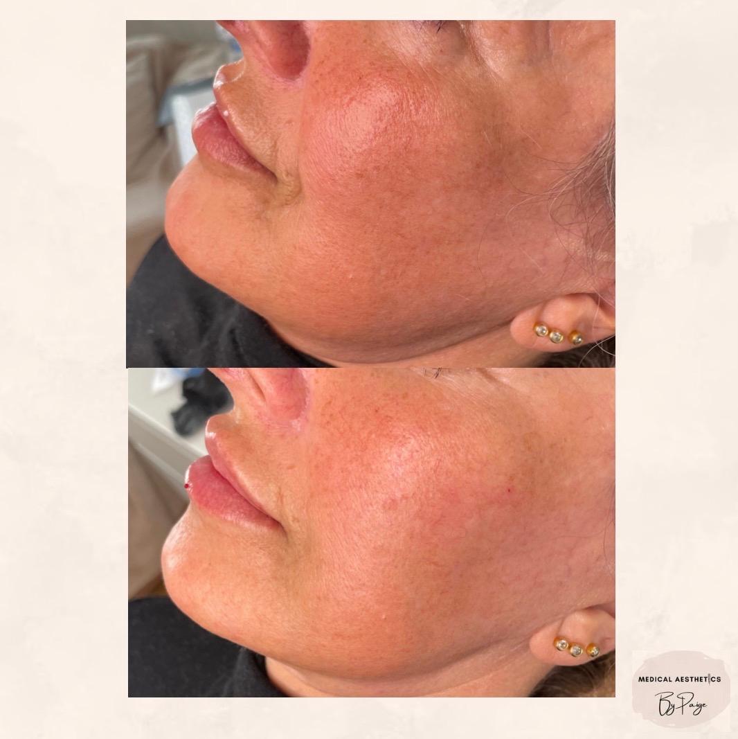 Medical aesthetics image 3