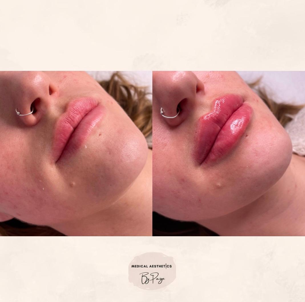 Medical aesthetics image 2
