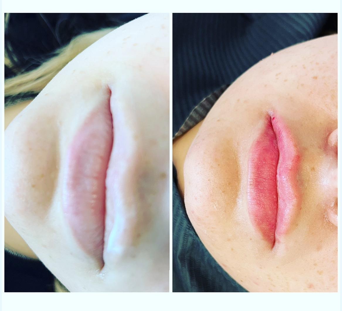 Charlotte small skin clinic image 3