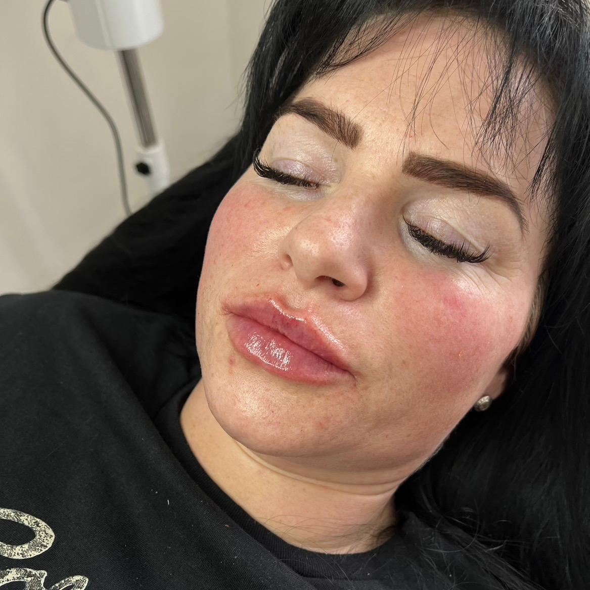 BH face lab image 2