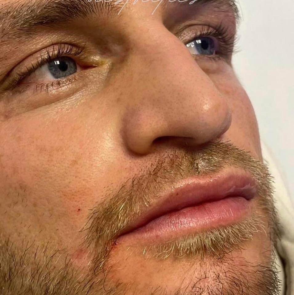 Enhance image 3