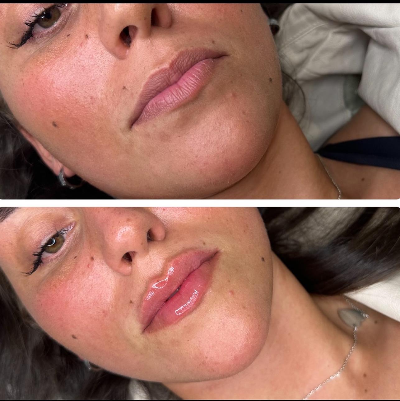 Enhance Cp Aesthetics image 2