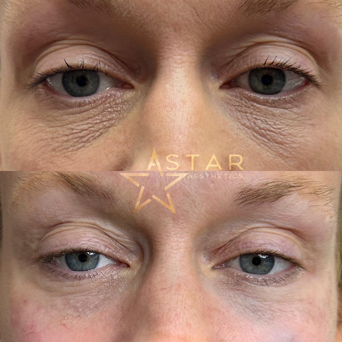 Wisbech A-star Aesthetics image 3