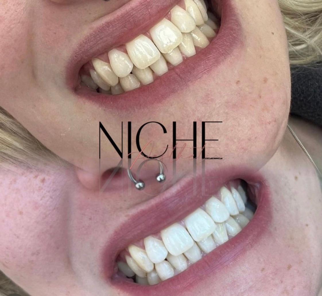 Niche Beauty image 2