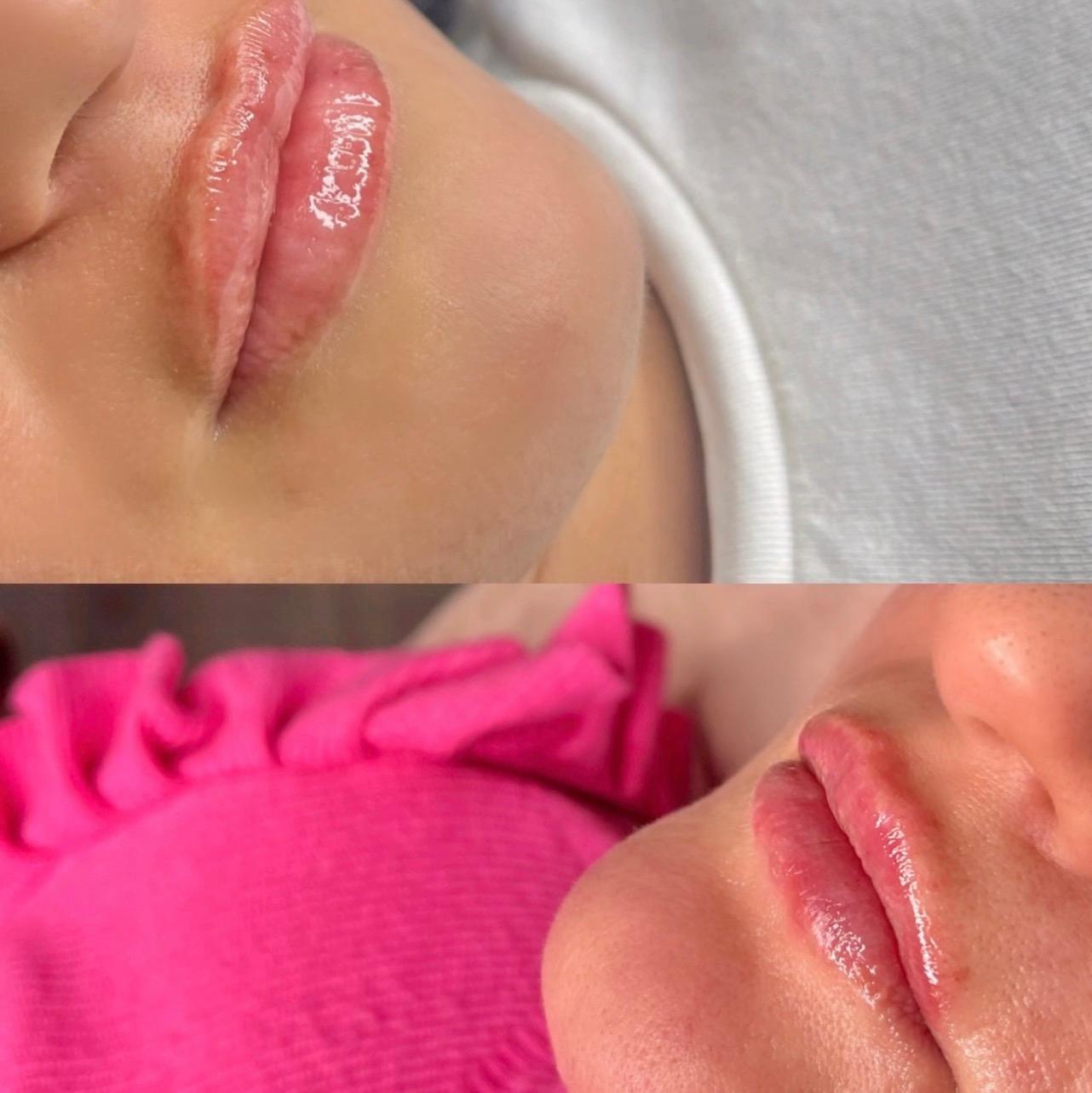 BeautyFly image 1
