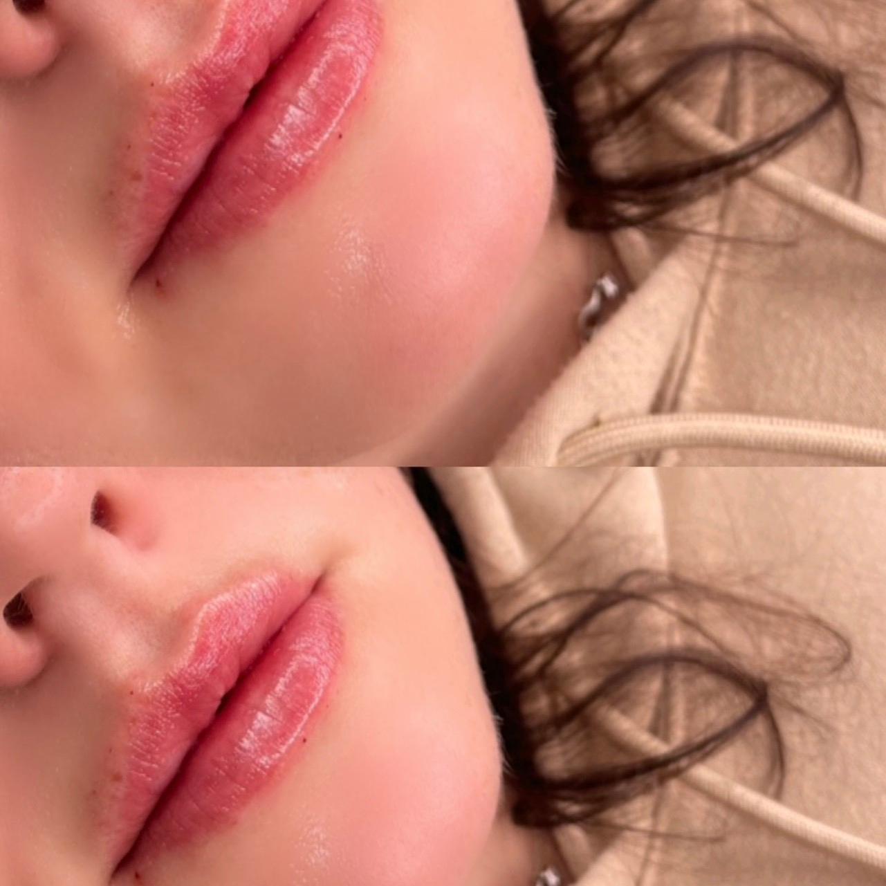 BeautyFly image 2