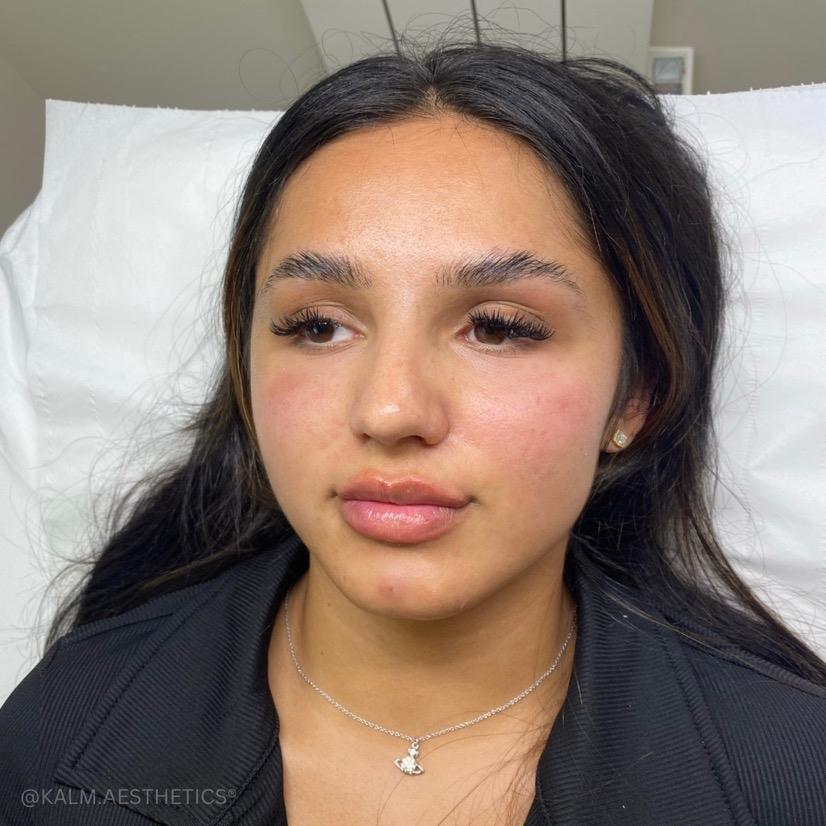 KALM aesthetics image 1