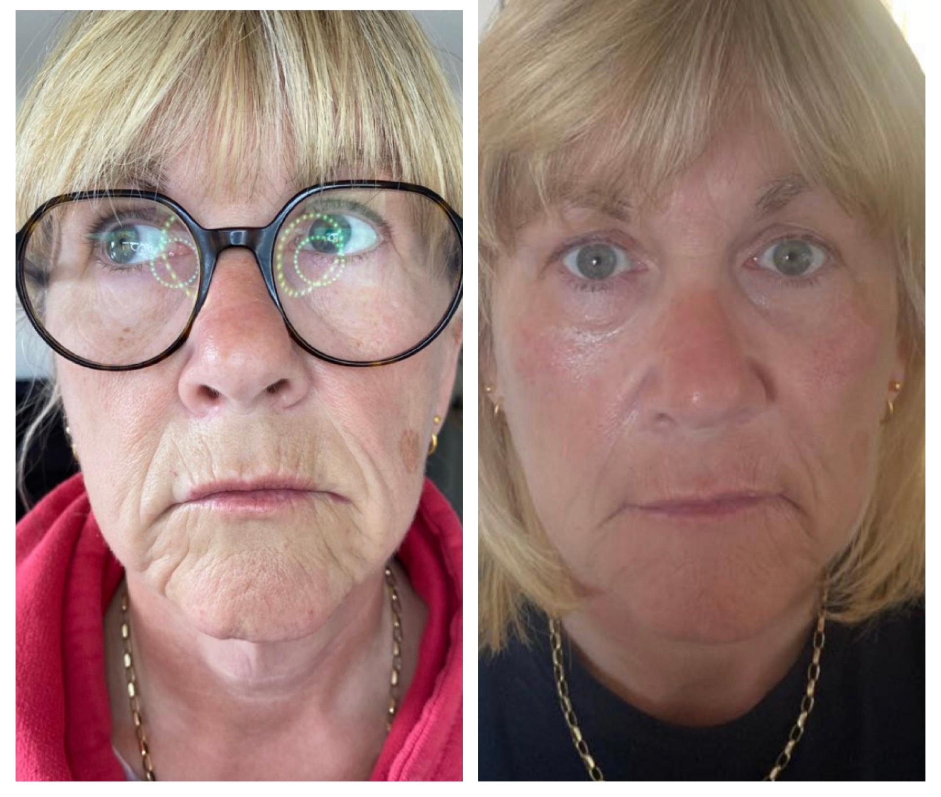 Ebor Derma Aesthetics image 3