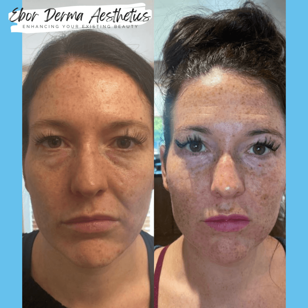 Ebor Derma Aesthetics image 2