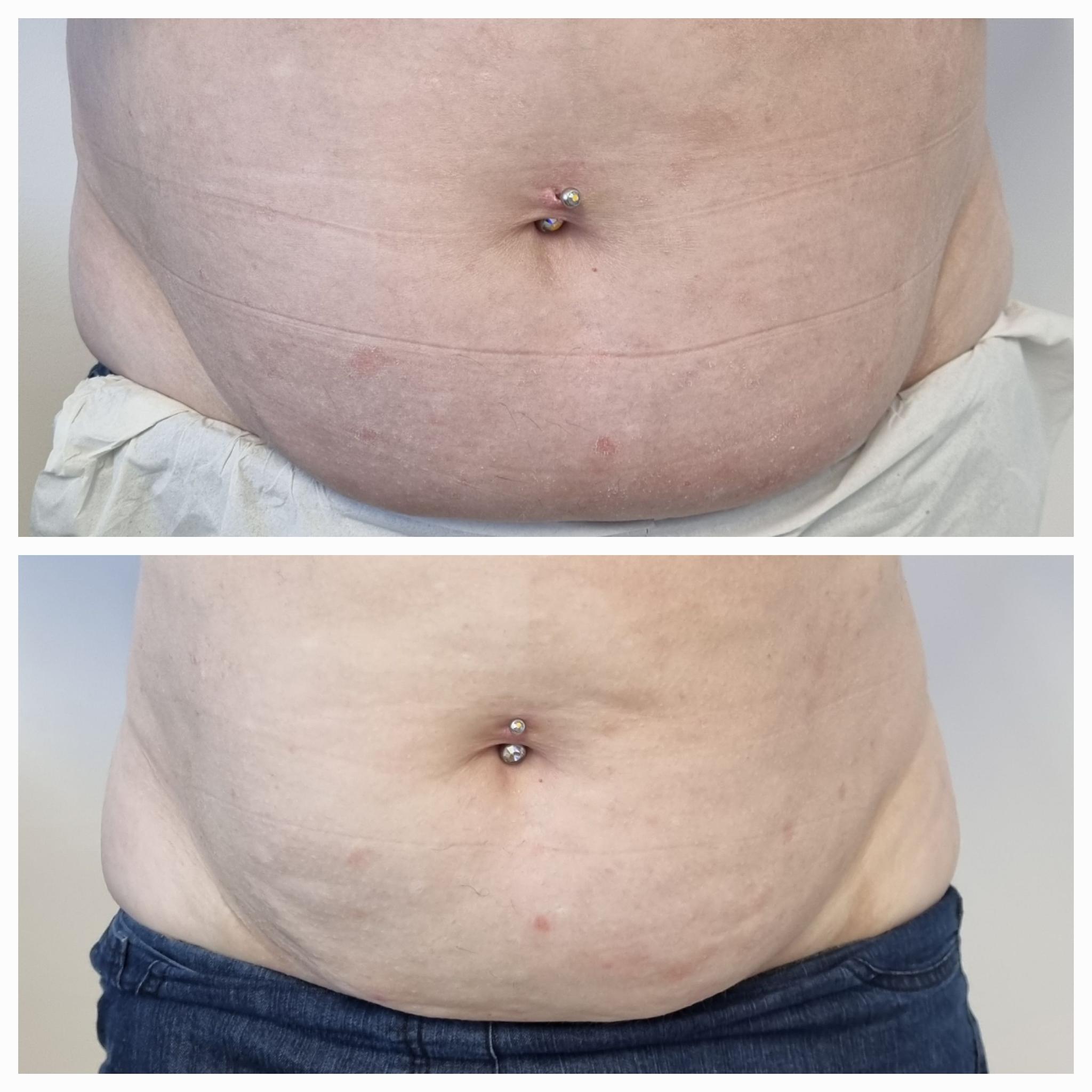 Bellus Aesthetics and Beauty image 3