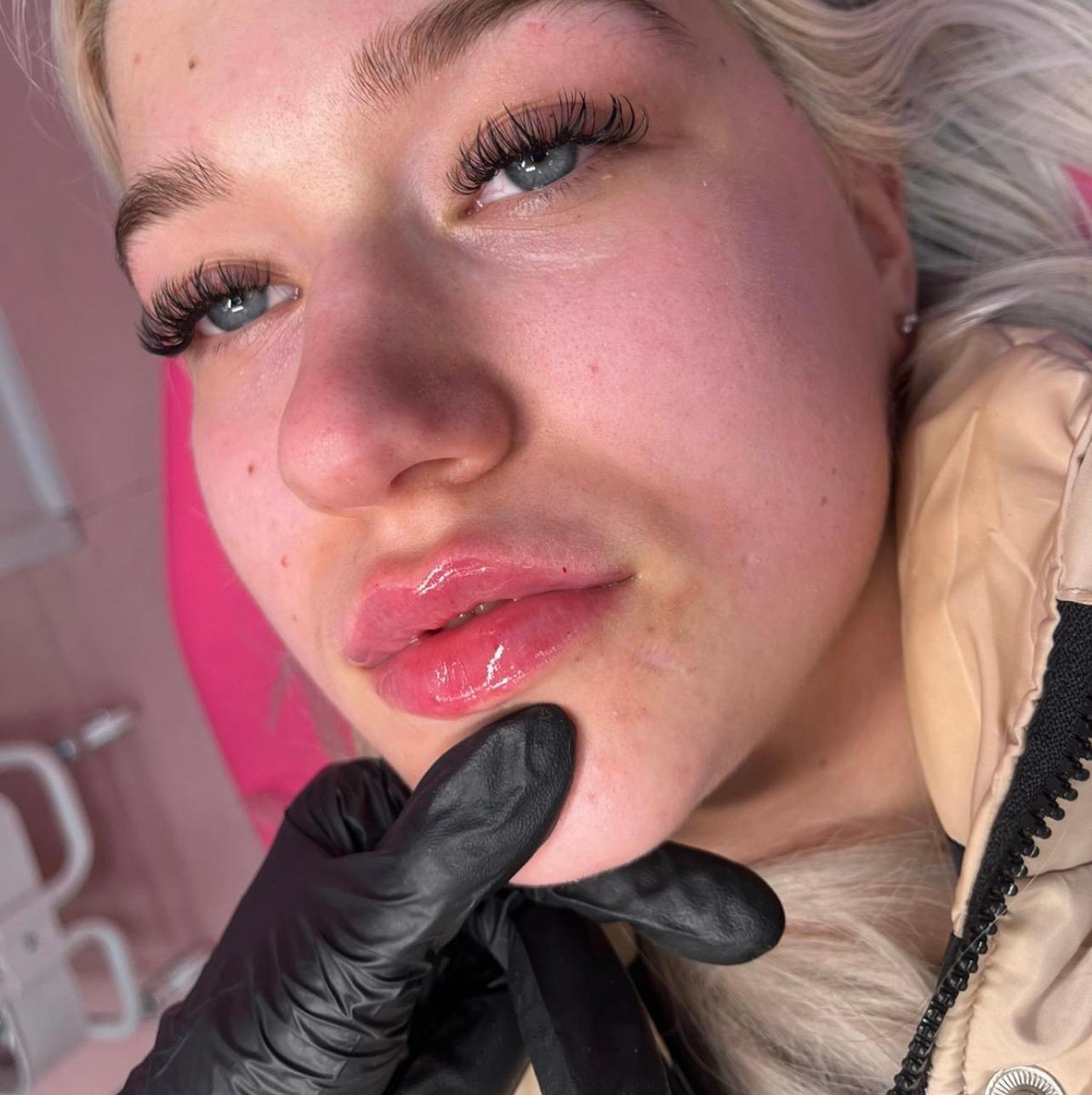 Peachy Pout Aesthetics image 3