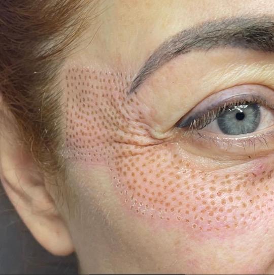 Queeny Eye image 3