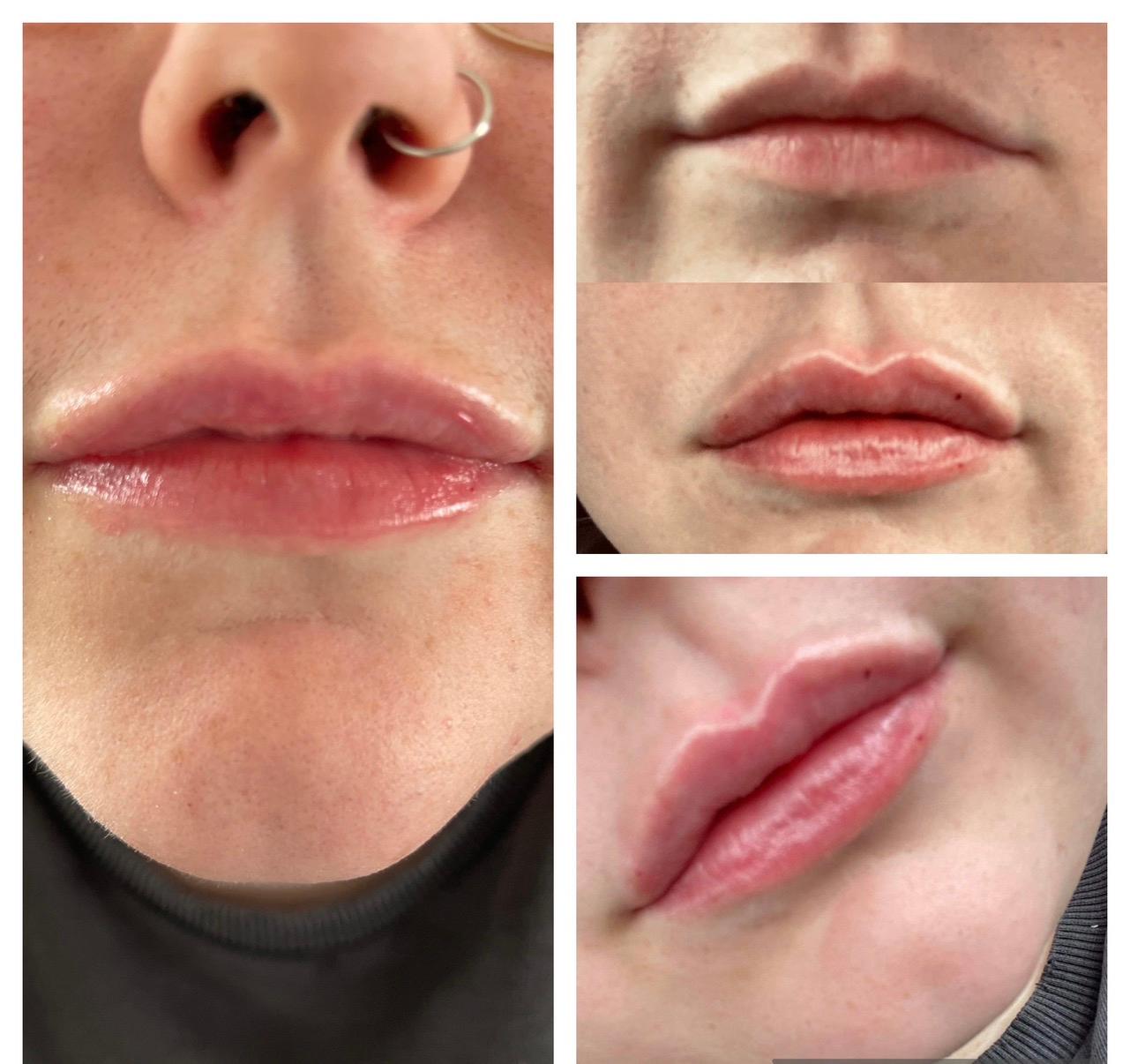 Anti wrinkle image 2