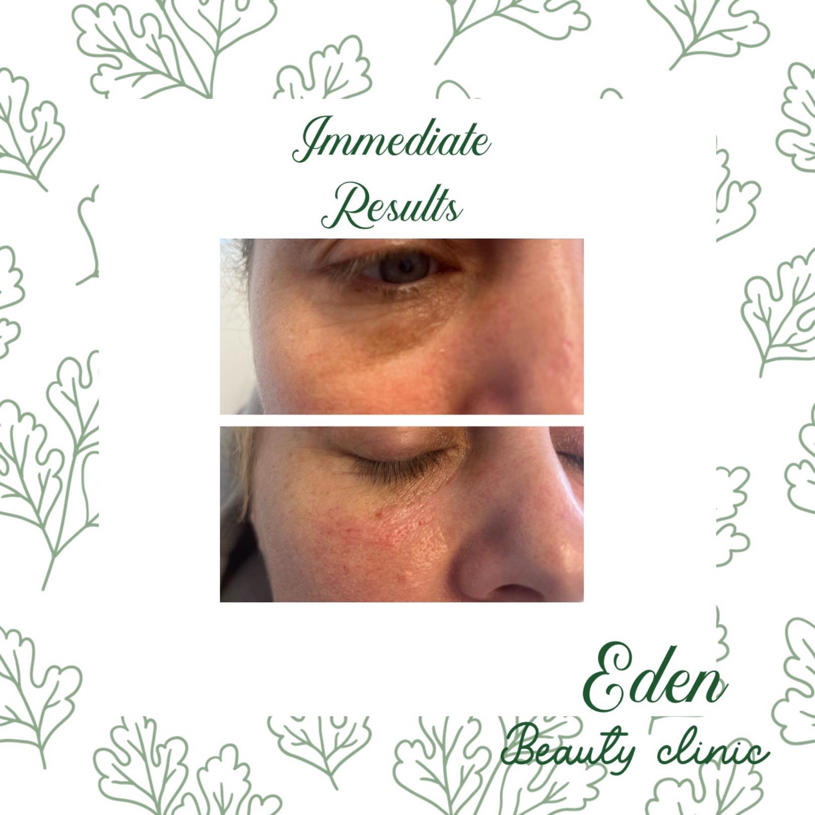 Eden beauty clinic image 1