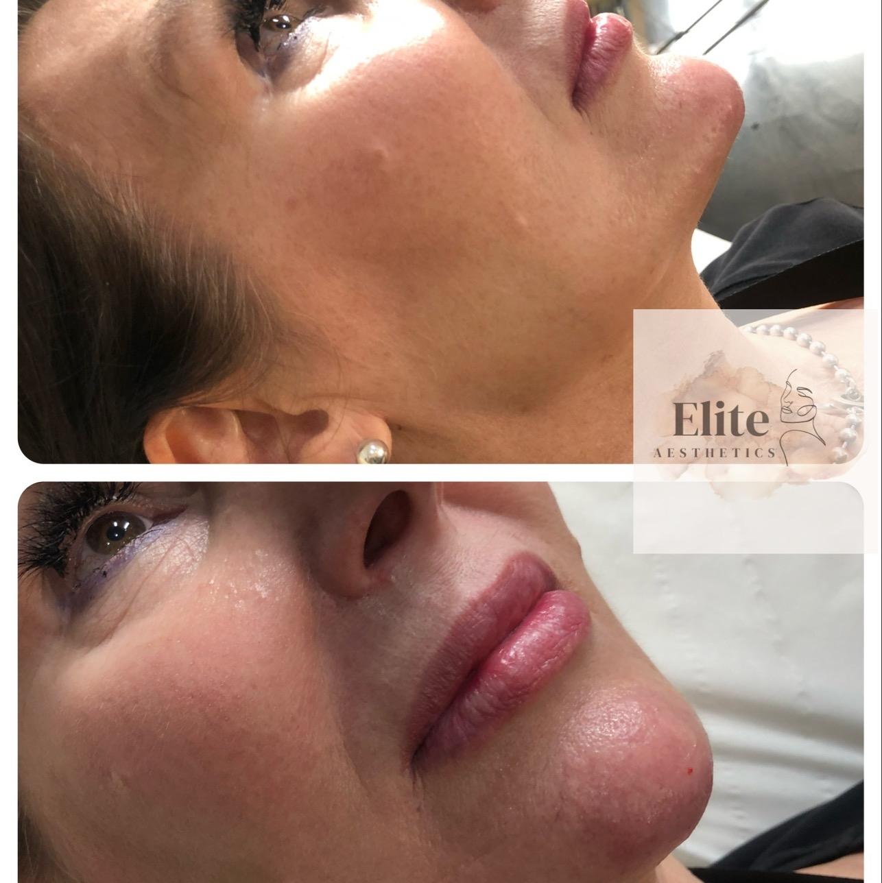 Elite Aesthetics Group image 2