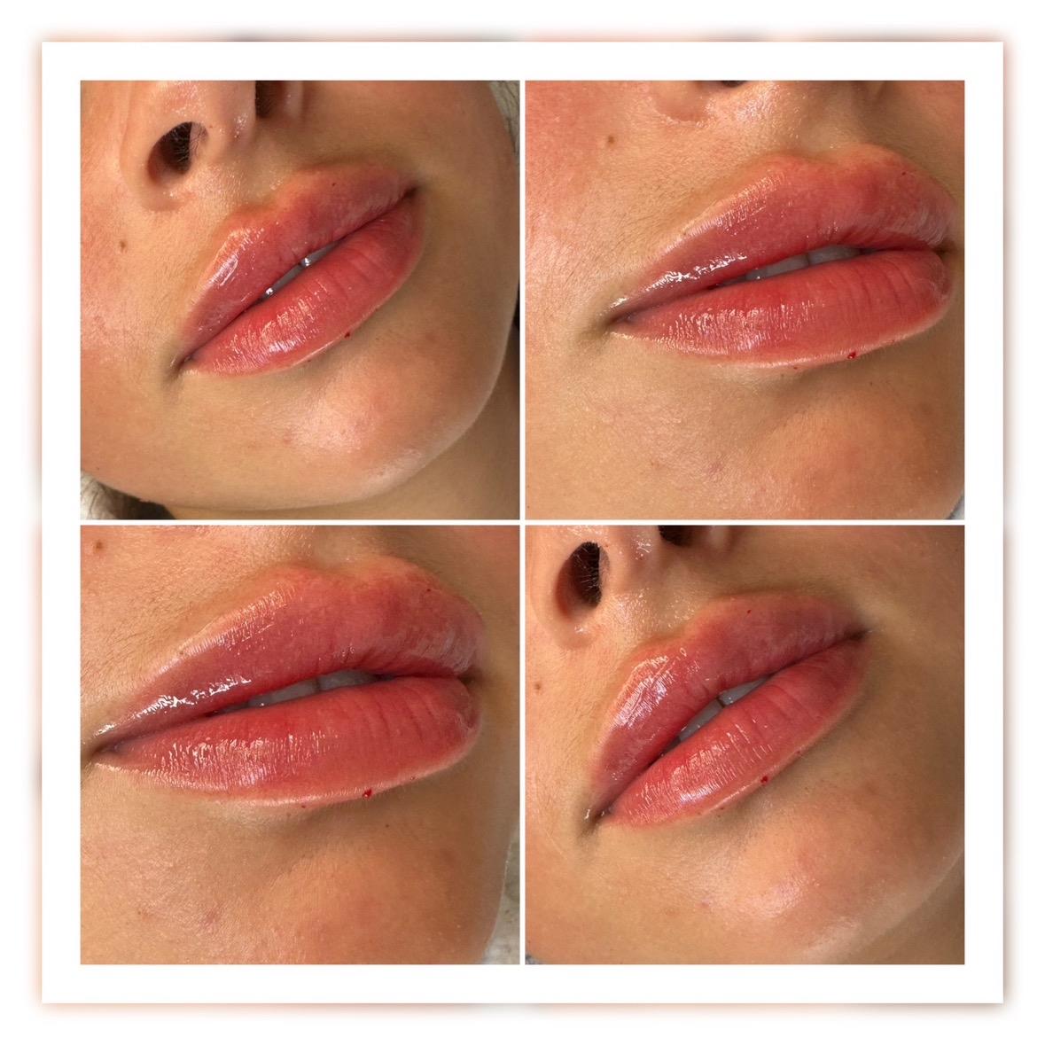 Aurora Harlow Aesthetics image 2