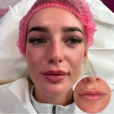 Meraki Aesthetics image 2