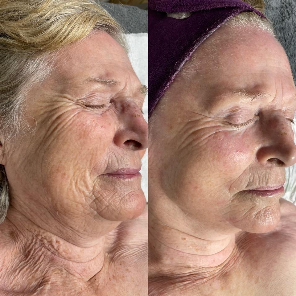 Declare Skin and Beauty Clinic image 2