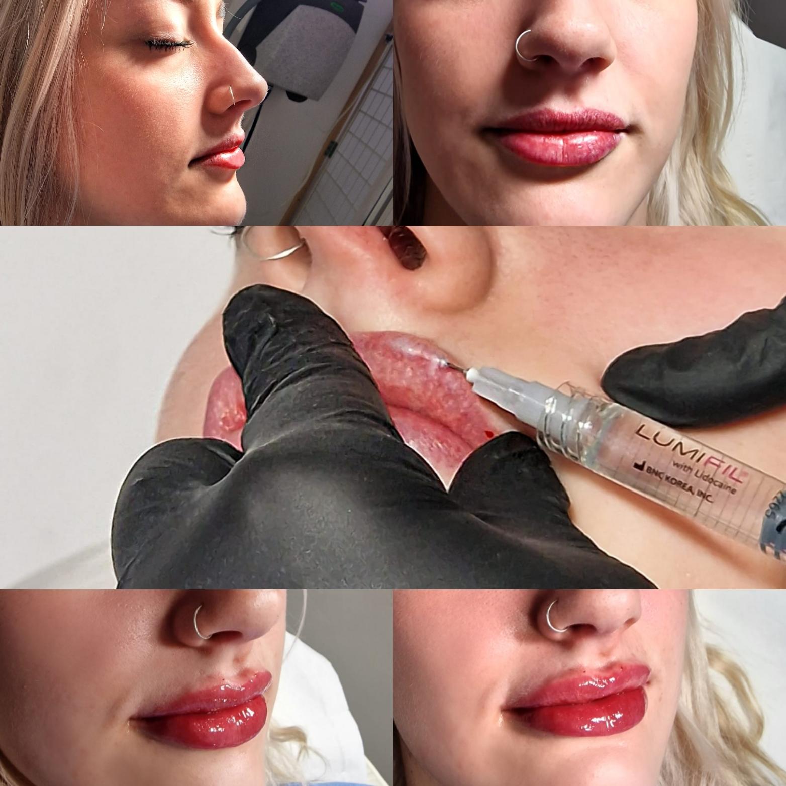 Aesthetics With Aimee - Studley image 2