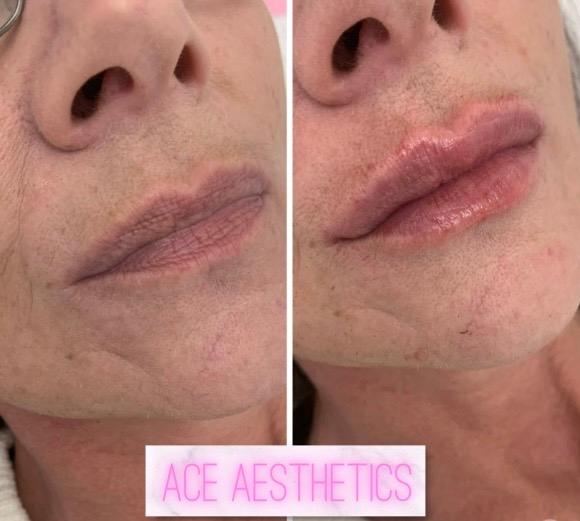 ACE Aesthetics image 2