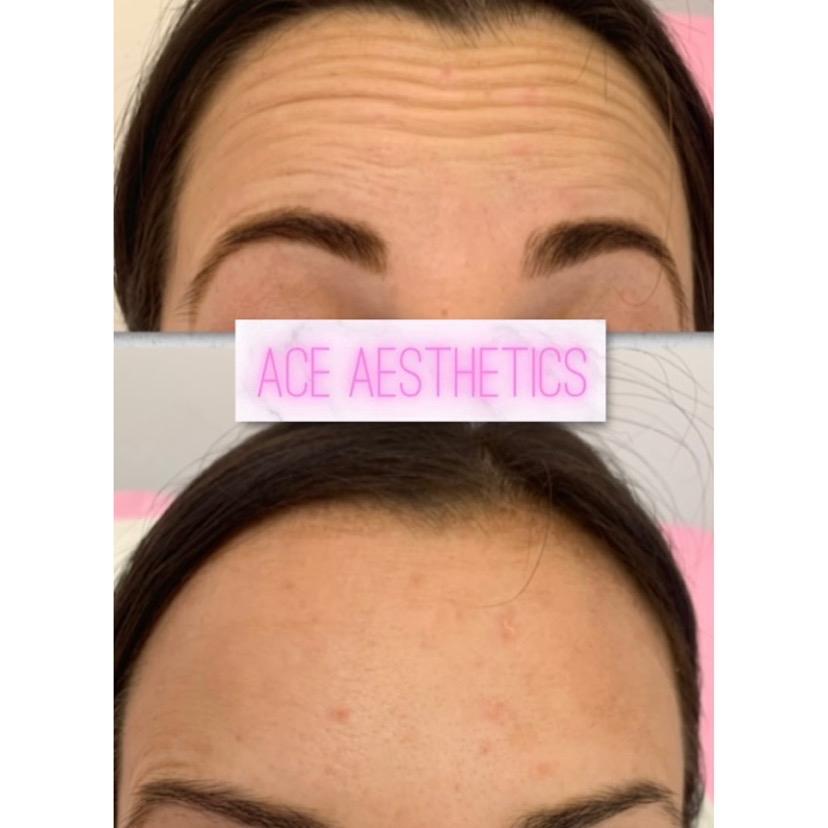 ACE Aesthetics image 3