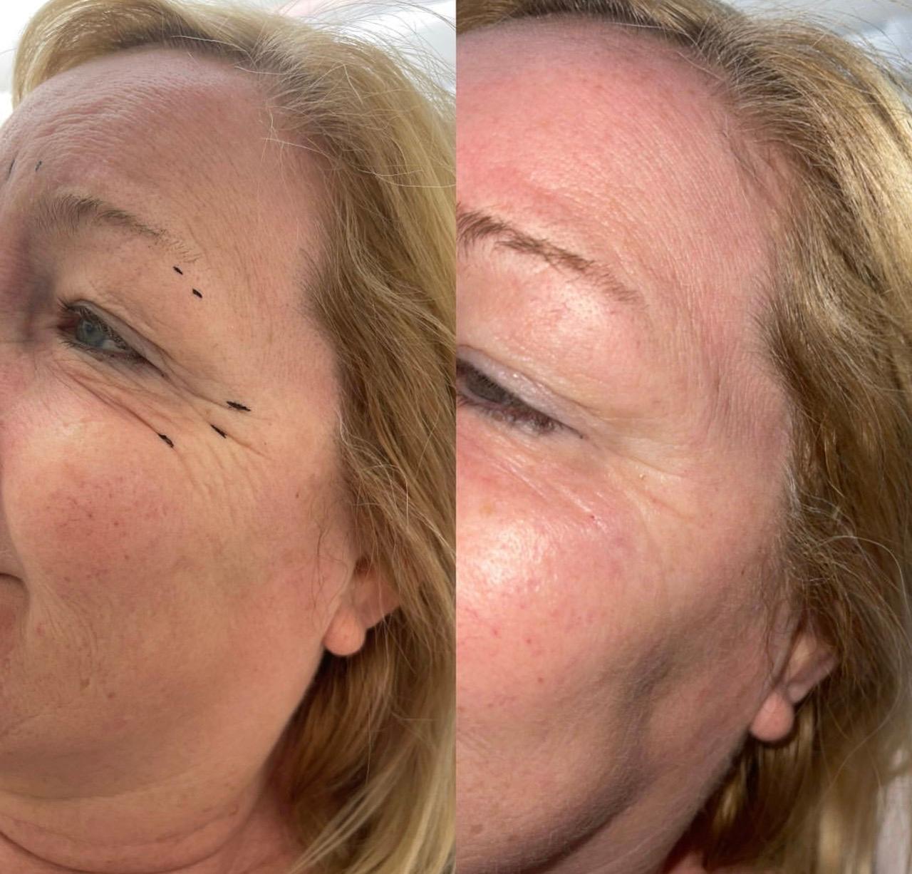 Teigan Herbert Aesthetics and Beauty Ltd image 2
