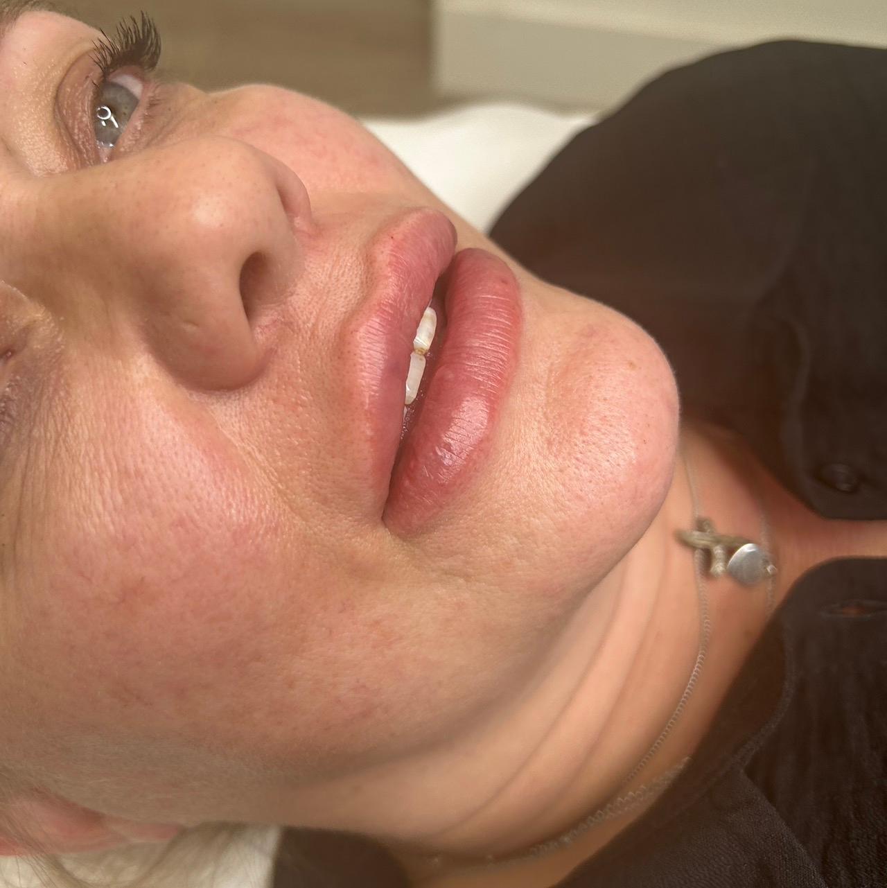 PhatFaceAesthetics image 2