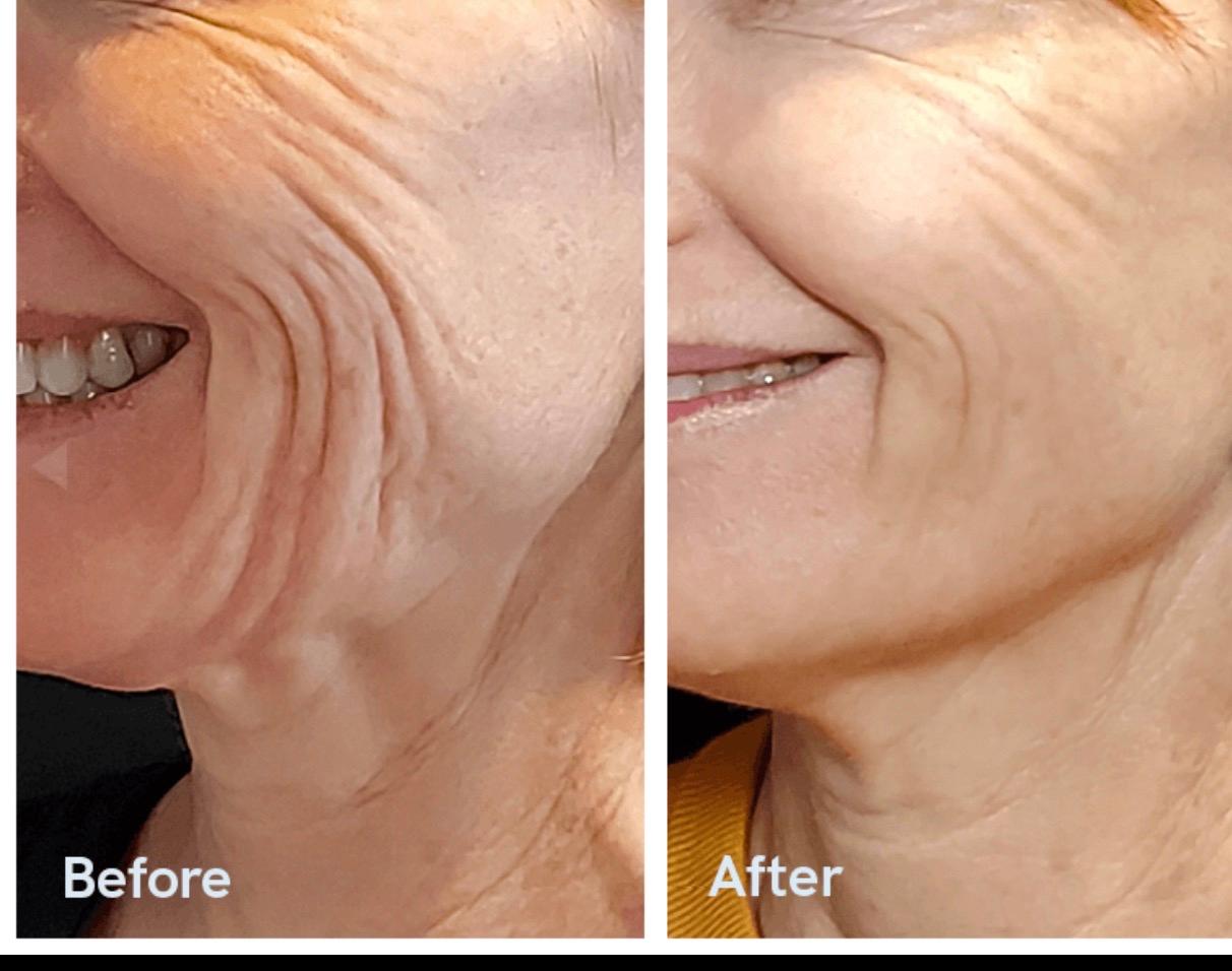 Lionsgate Aesthetics and Wellness image 3