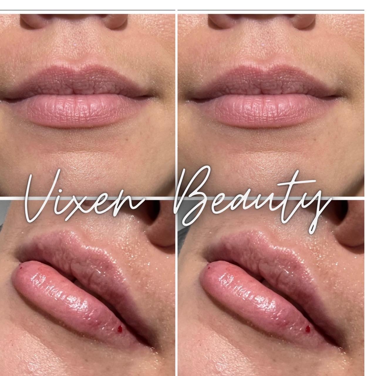 ViXon Beauty image 2
