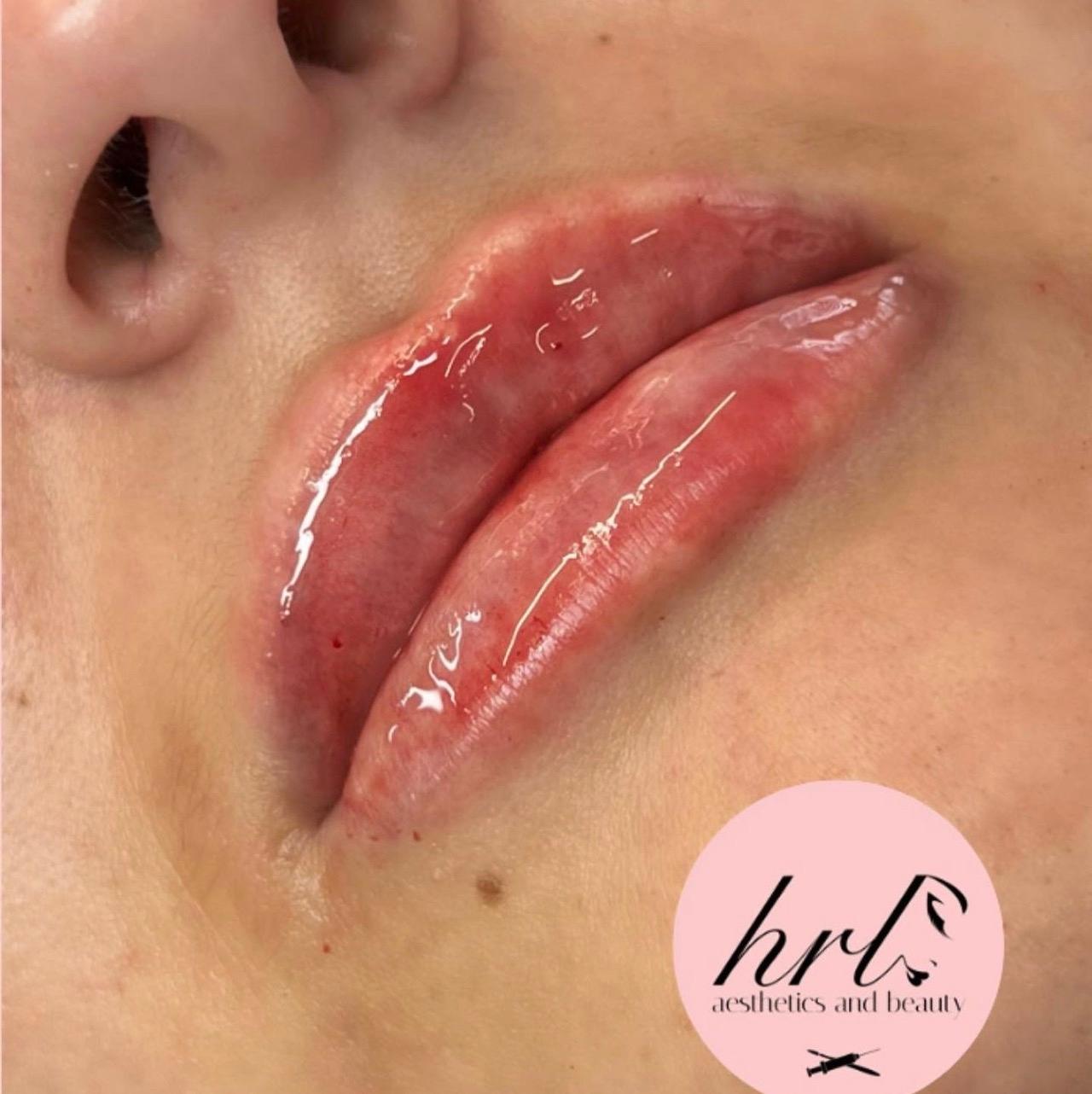 HRL Aesthetics and Beauty image 3