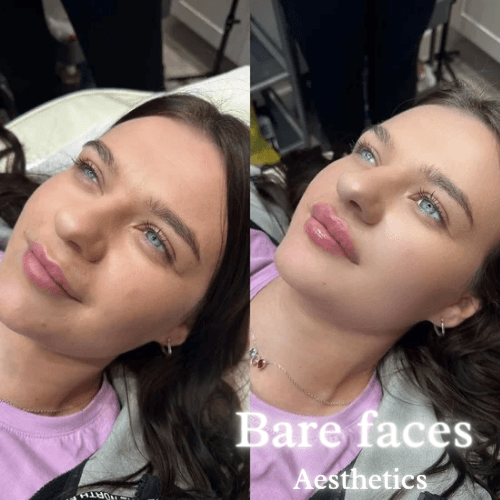 Bare Faces Aesthetics image 3