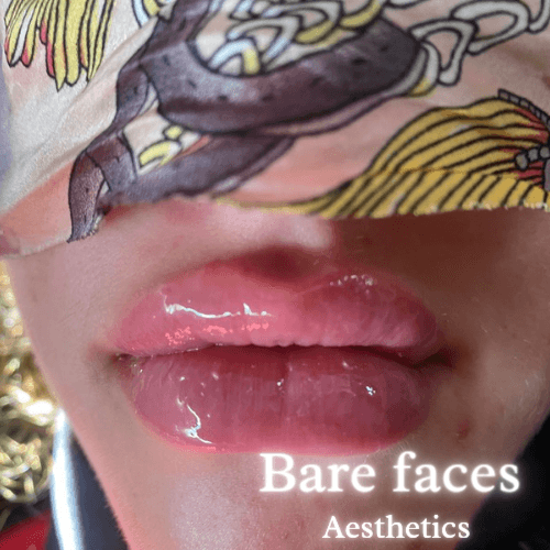 Bare Faces Aesthetics image 2