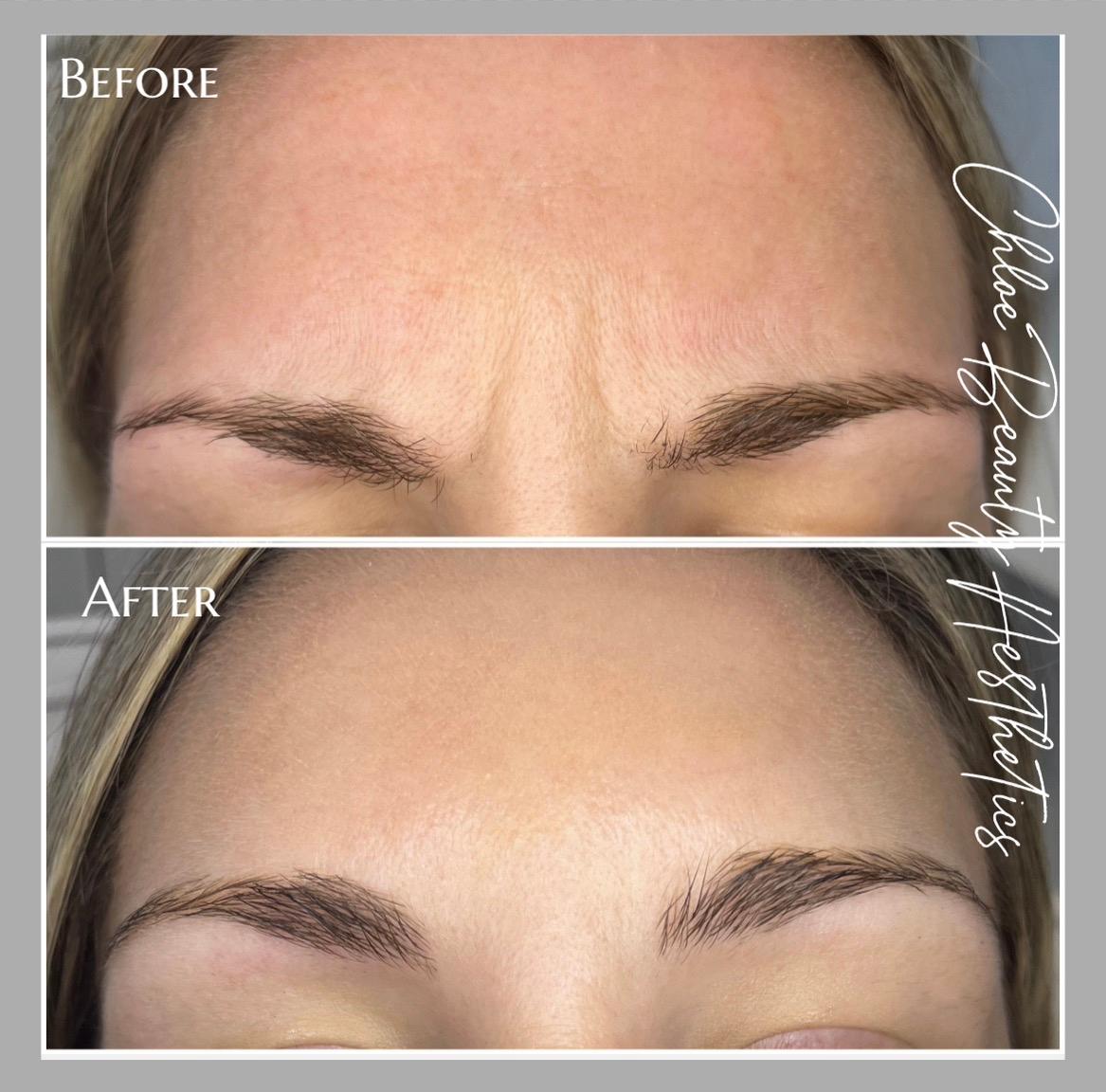Chloe Beauty Aesthetics image 3