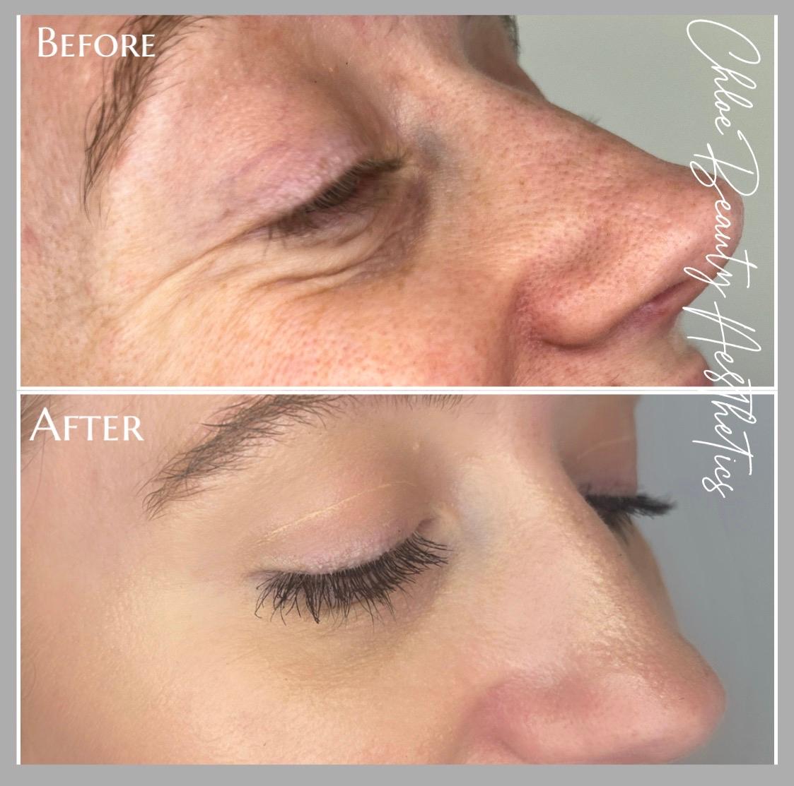Chloe Beauty Aesthetics image 2