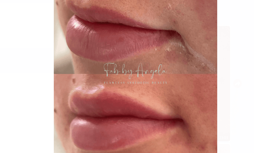 Flawless Aesthetic Beauty FAB BY Angela image 1