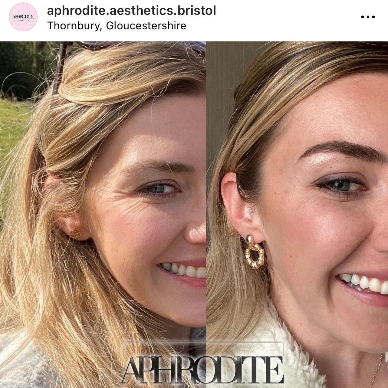 Aphrodite aesthetics image 3