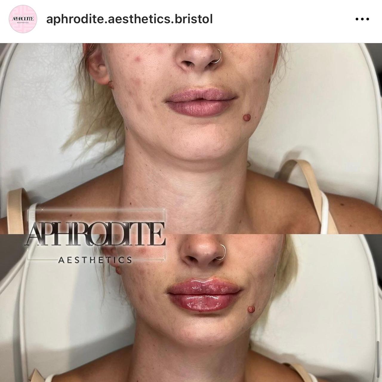 Aphrodite aesthetics image 2