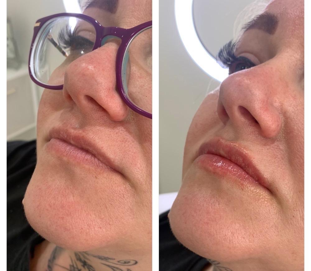 RS Aesthetics Newquay image 1