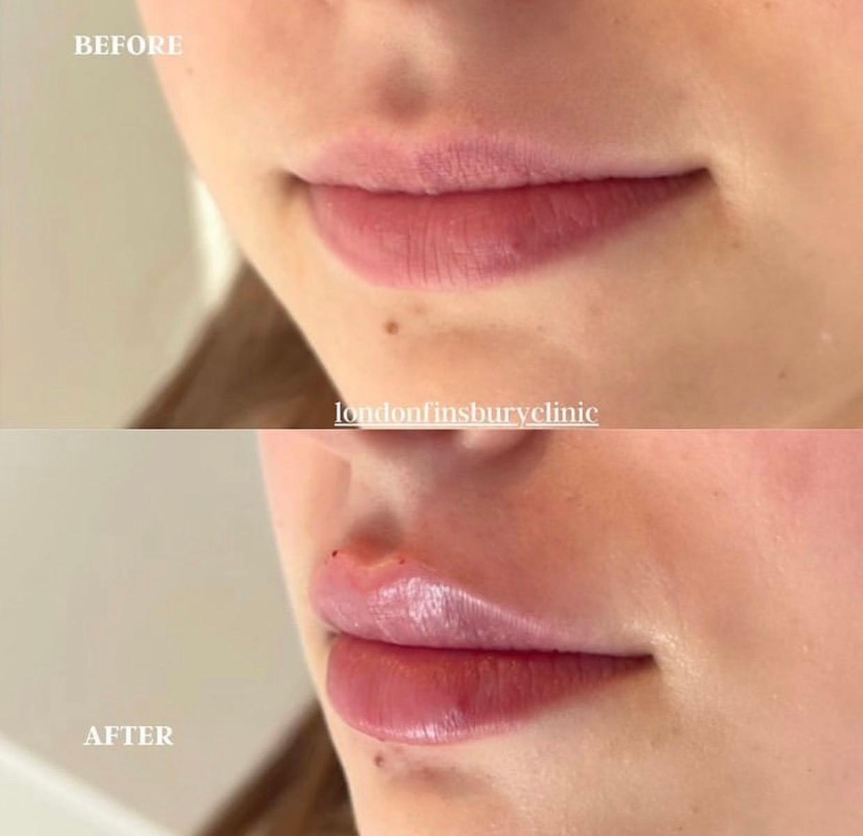 Glam beauty aesthetics image 3